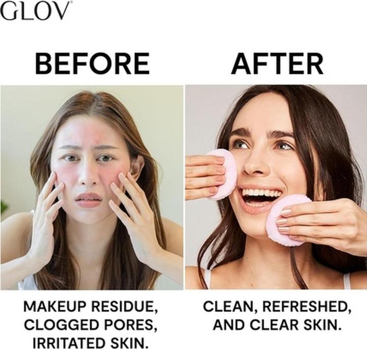 Actual product image Glov SET Starter Oily Skin Pads waciki do twarzy + All Skin Types Pads waciki do twarzy + Dry Skin (86.18 g)