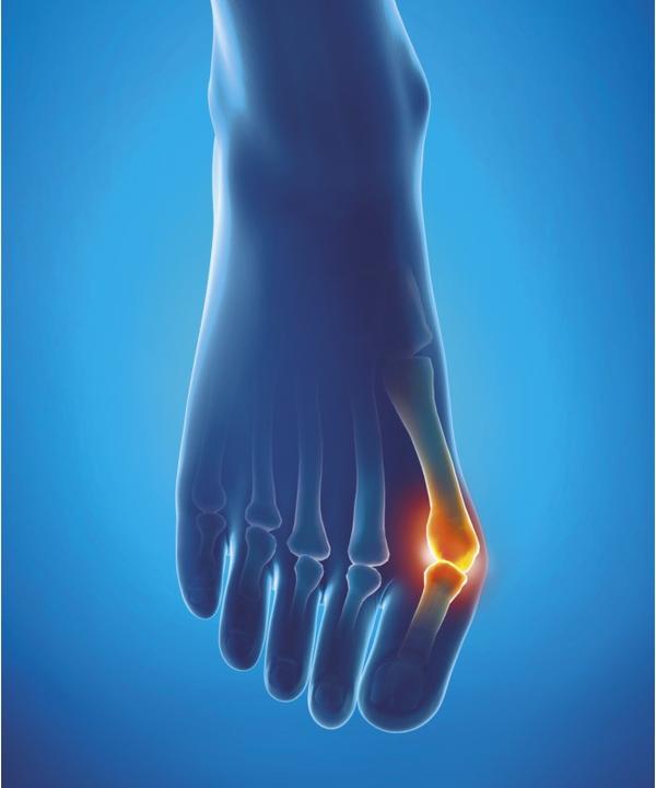 Produktbild Epitact Hallux Valgus Schutz M 24-27 cm 1 Stück (M)