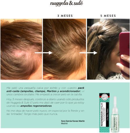 Produktbild Nuggela & Sulé REGENERADOR CAPILAR 10 ml (10 ml)