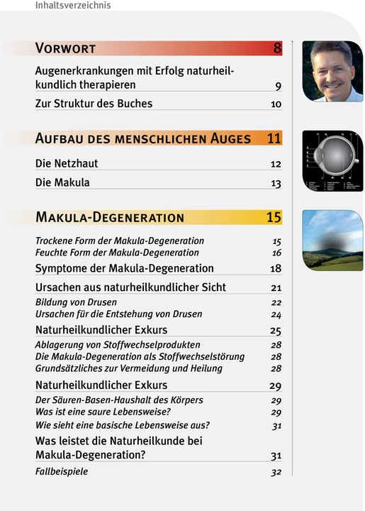 Image du produit Makula-Degeneration und Diabetische Retinopathie (Allemand, Andreas Nieswandt, 2024)