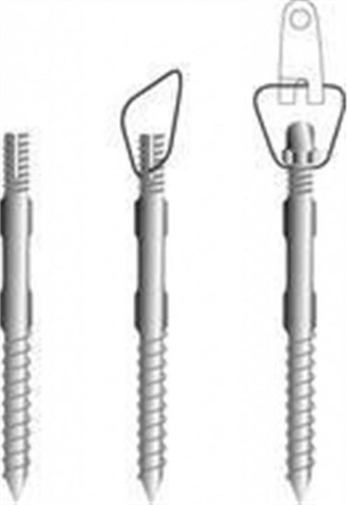 Actual product image Peddy Shield Point fixation