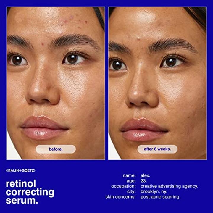 Produktbild Malin+Goetz Retinol Correcting Serum (30 ml)