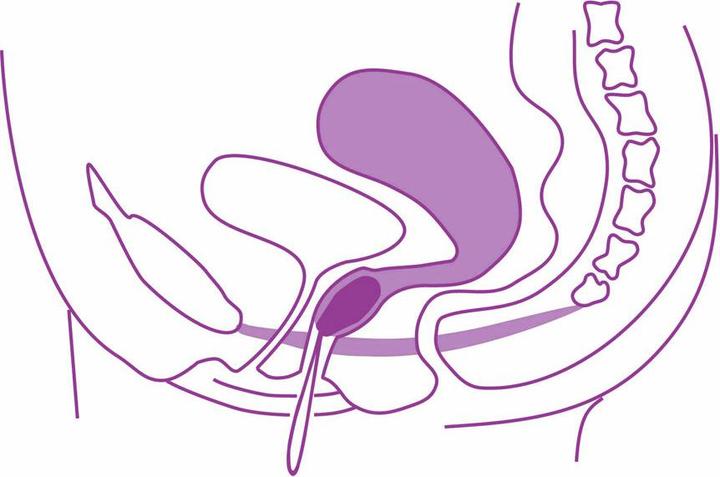 Immagine prodotto Elanee Aiuto per l'allenamento del pavimento pelvico